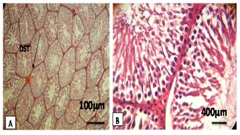 Figure 2-A, B.