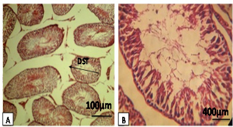 Figure 3A, B.