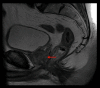 Figure 11.