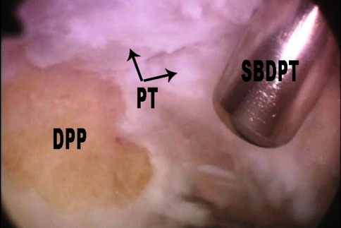 Fig. 2