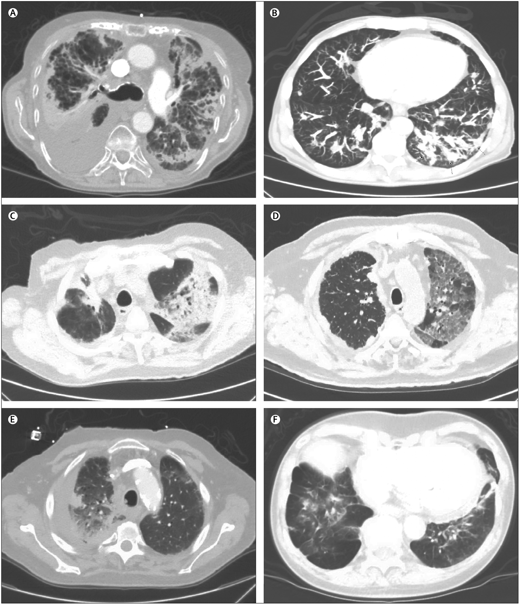 Figure 2: