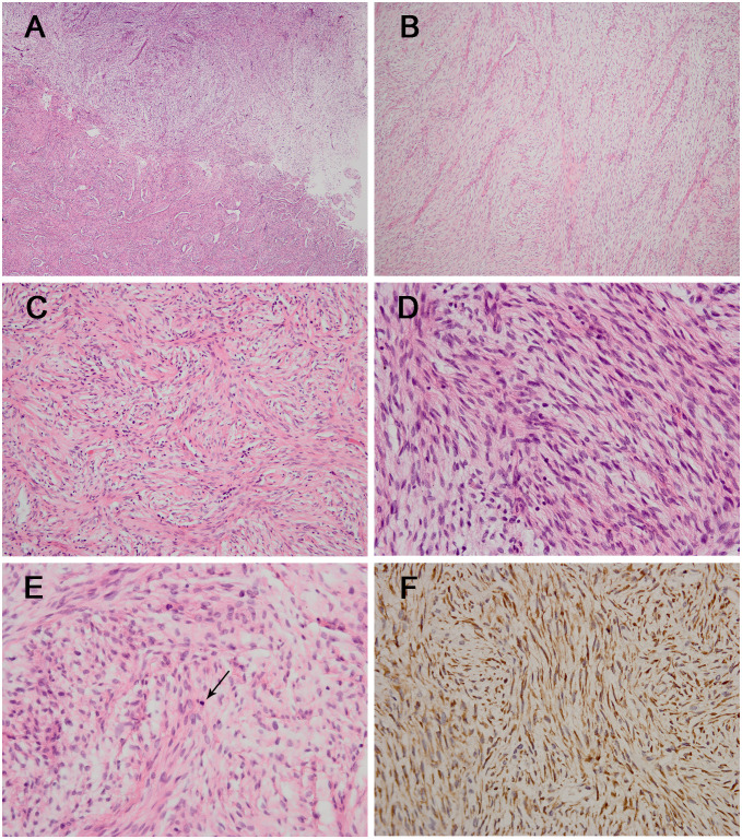 Figure 2