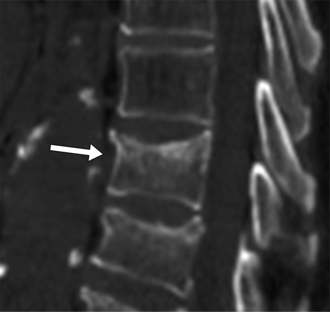 Figure 5b: