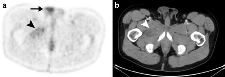 Fig. 5