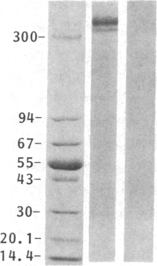 graphic file with name pnas00323-0169-d.jpg