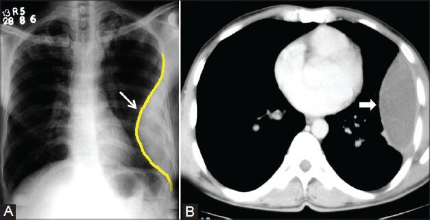 Figure 3 (A, B)