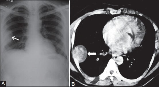 Figure 6 (A, B)