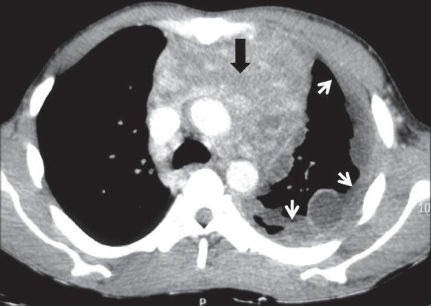 Figure 22