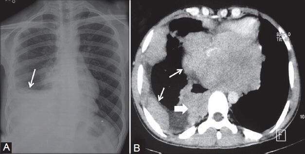 Figure 23 (A, B)