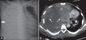 Figure 24 (A, B)