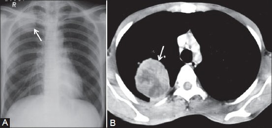 Figure 7 (A, B)