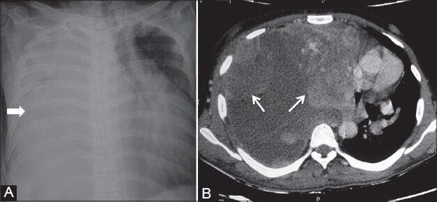 Figure 24 (A, B)