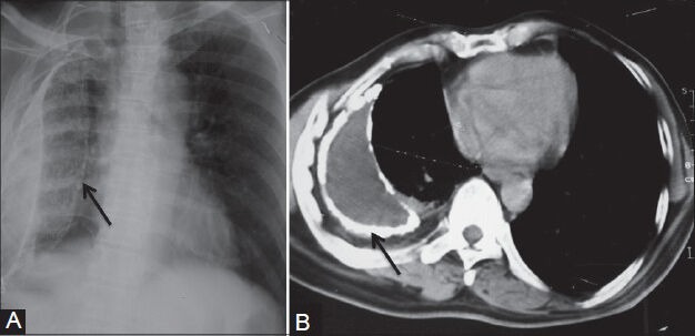 Figure 4 (A, B)