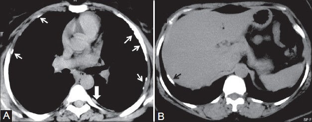 Figure 14 (A, B)