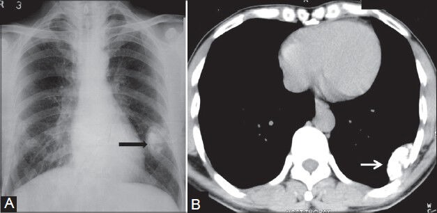 Figure 17 (A, B)