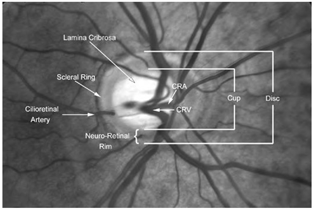 Figure 2A: