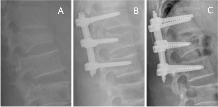 Fig. 7