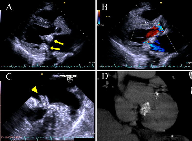 Figure 2.