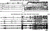 Fig. 3. B: