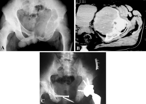 Fig. 1A–C