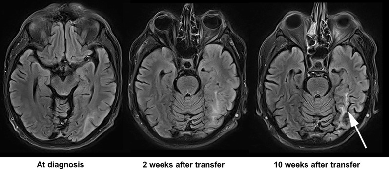 Fig. 2