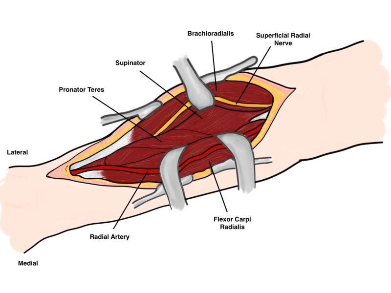 Figure 9