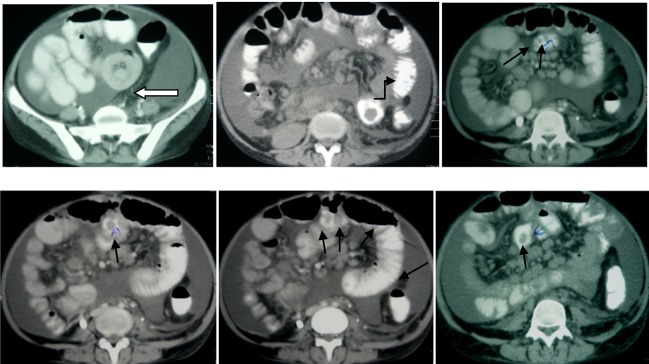 Fig (1AB)