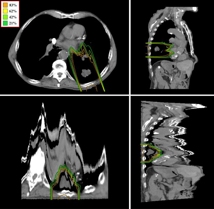 FIG. 6