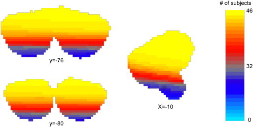 Fig. 1