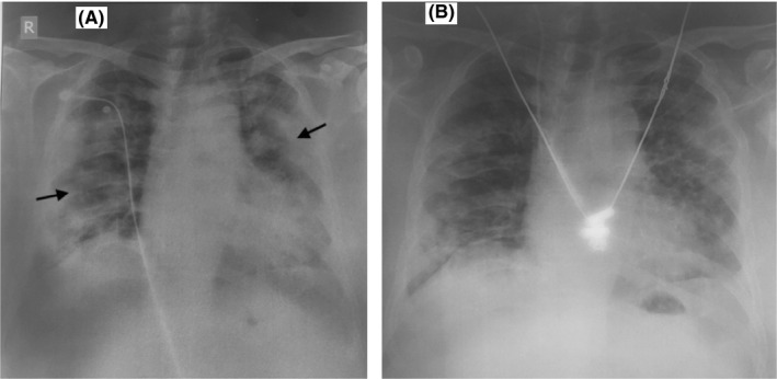 FIGURE 2