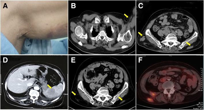 Fig. 1