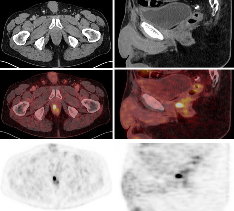 Fig. 2