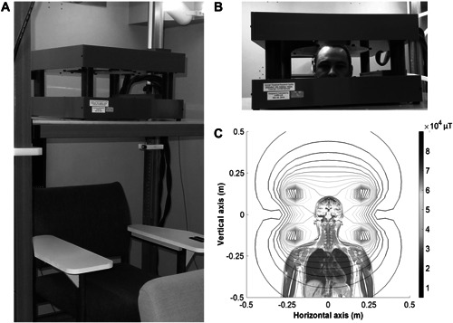 Fig. 1