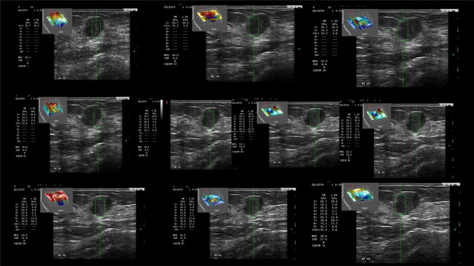 Fig. 4