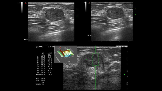 Fig. 5