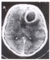 Figure 1)