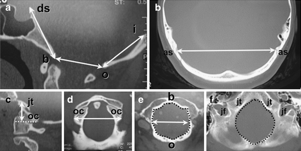 Fig. 1