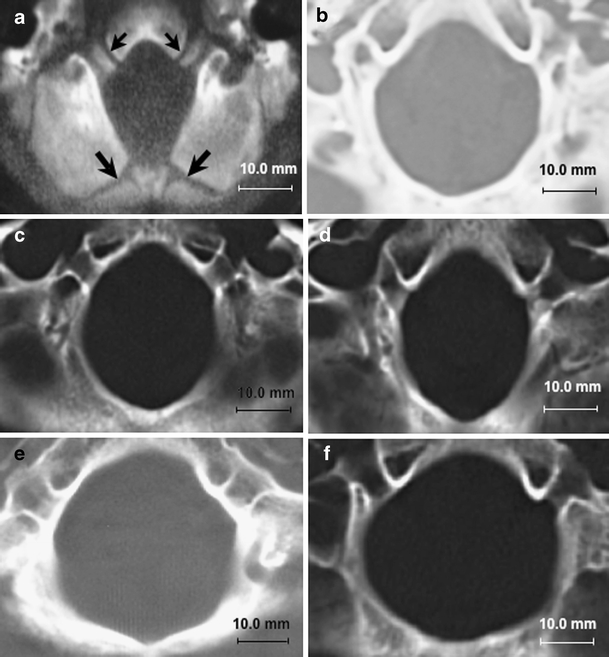 Fig. 4