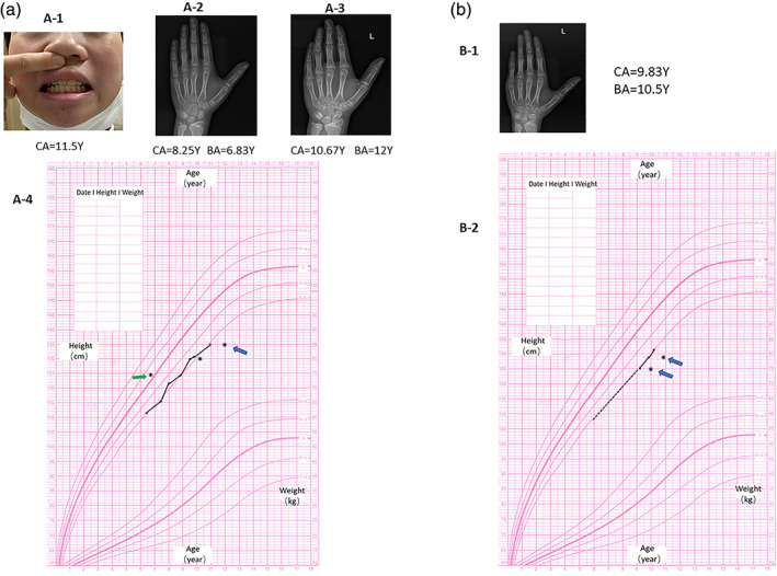 FIGURE 2