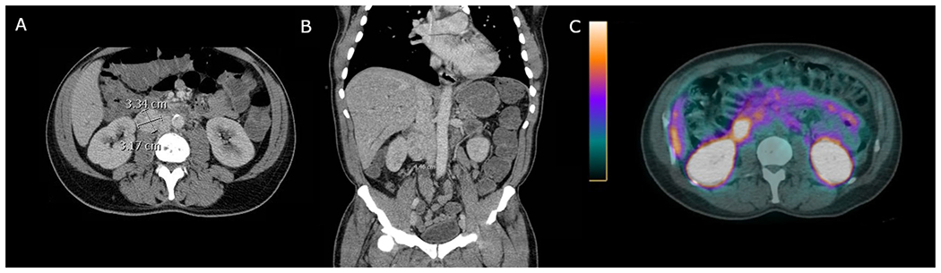 FIG. 2