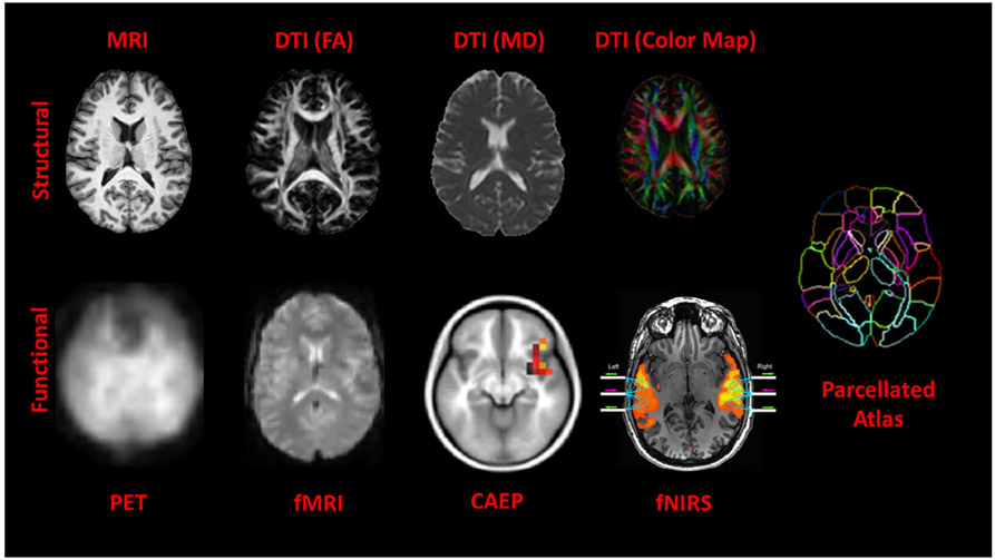 FIGURE 1