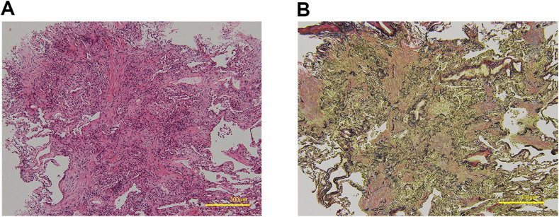 Fig. 3