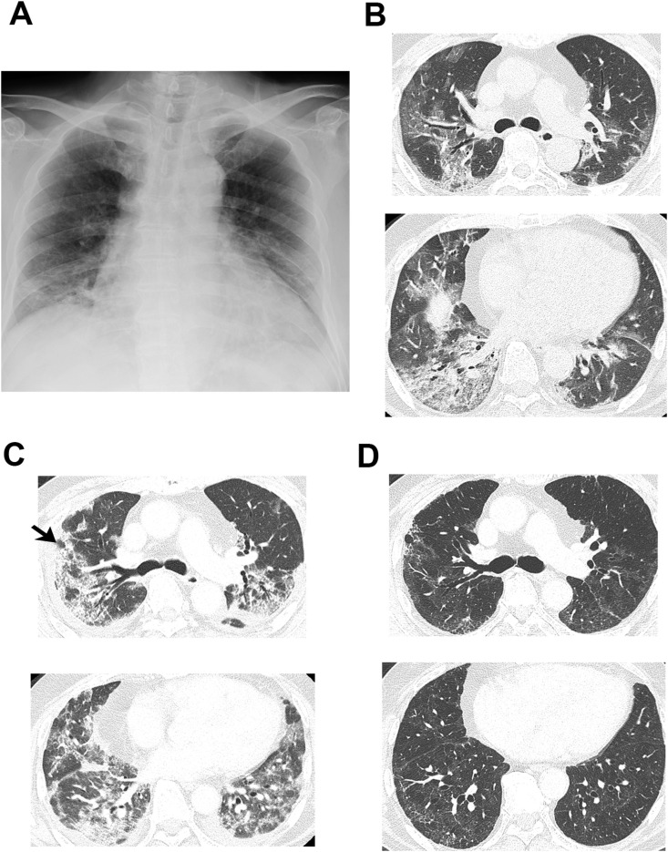 Fig. 1