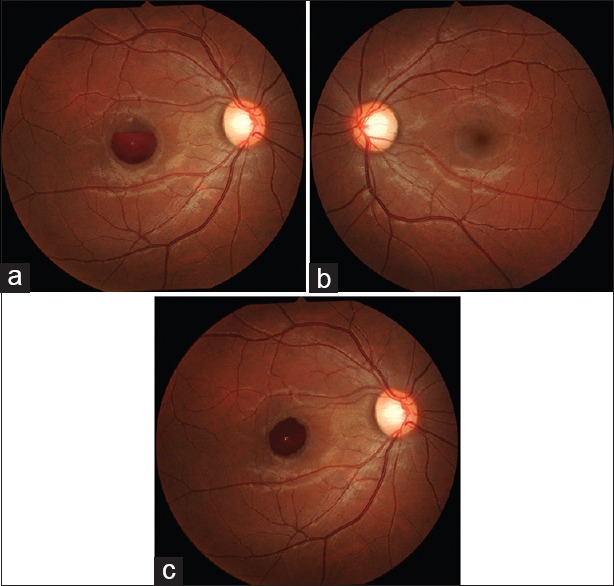 Figure 6