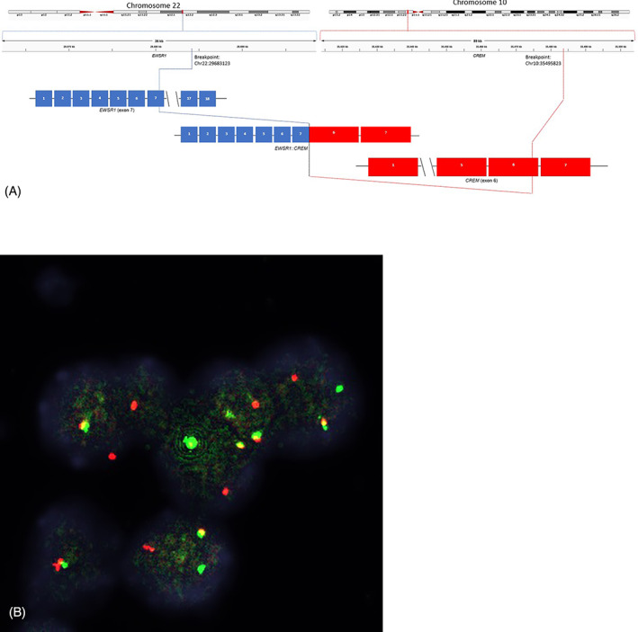 FIGURE 2