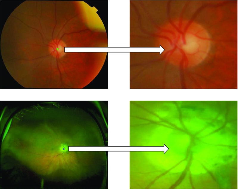 Fig. 3