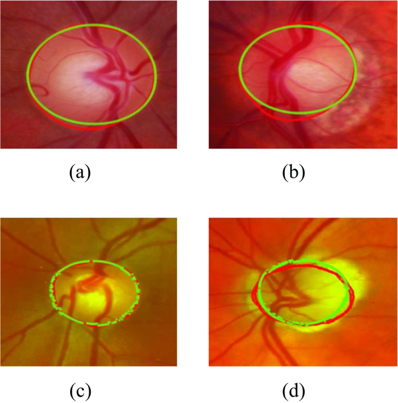 Fig. 10