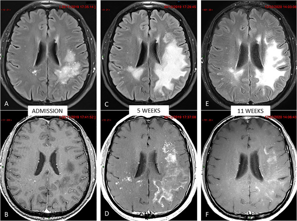 FIGURE 1