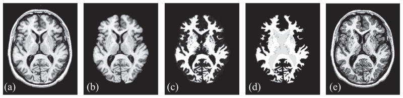 Fig. 2