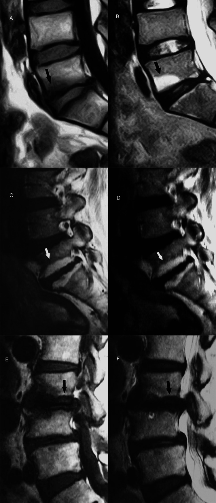 Figure 13